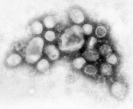 swinevirus.jpg